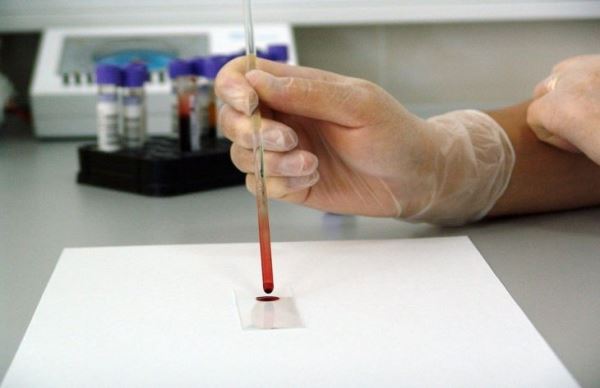 Ученые: рак легких можно будет распознать по простому анализу крови
