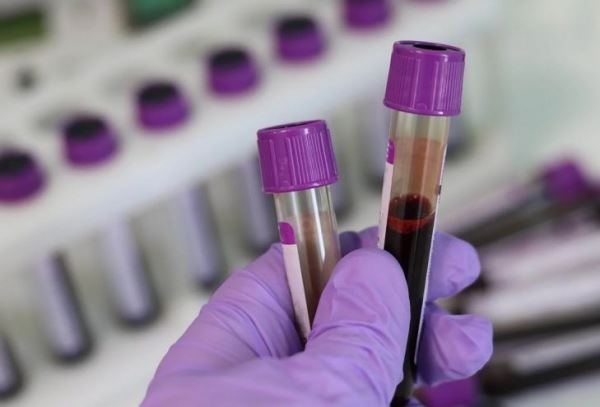 Люди с этой группой крови отличаются устойчивостью к онкологии